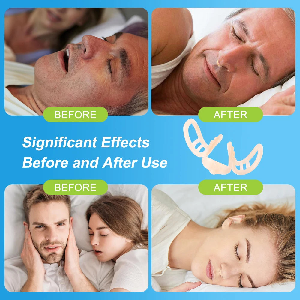 Before and after effects of using a sleep aid device on a couple.
