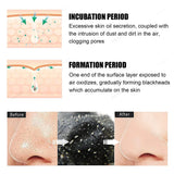 Diagram showing the formation of blackheads with labeled stages and text.