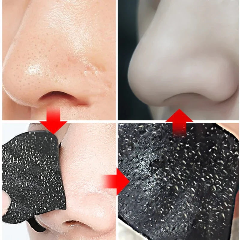 Before and after comparison of a nose with blackhead removal product application.