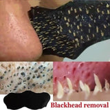 Blackhead removal product with close-up of nose and blackheads, labeled 'Blackhead removal'.